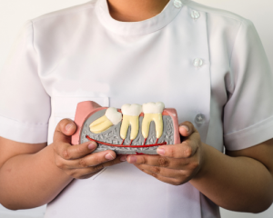 impacted wisdom tooth diagram